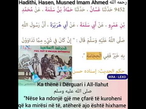 Hadithi:"Nëse ka ndonjë gjë me çfarë të kuroheni që ka mirësi në të,....