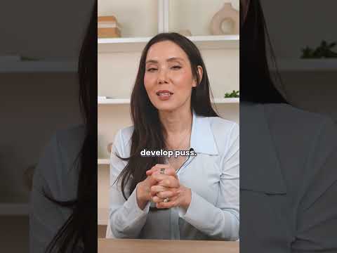 Physical Characteristics of Acne