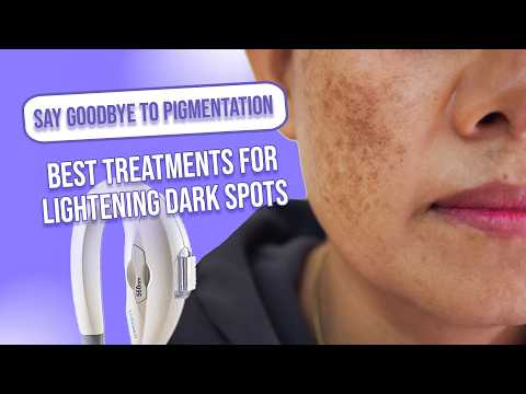 Dark Spots On Face Removal | Best Treatments