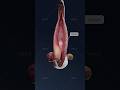 What Turns A Bartholin Cyst Into A Painful Abscess Study Gynecology In 3D With VOKA