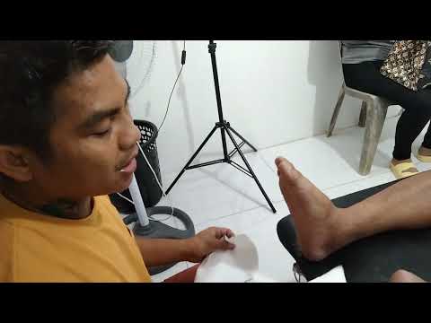 fracture calcaneus,,3 months na maga pa din..😱😱