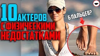 10 АКТЕРОВ С ФИЗИЧЕСКИМИ НЕДОСТАТКАМИ