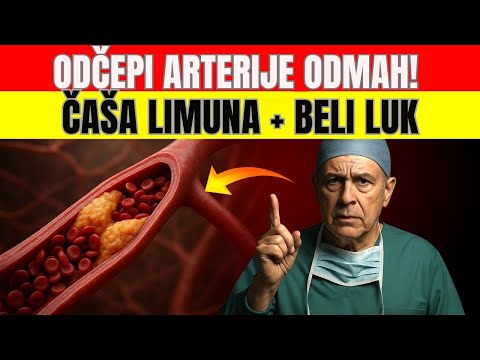 Zaboravite Skupe Lekove! Beli Luk i Limun ČISTI Arterije Za 7 Dana! | Zdrav Život