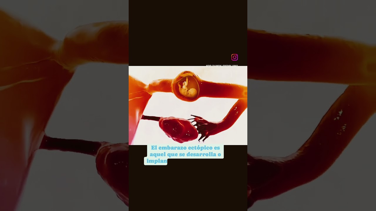 Ramón Antonio Alvarez Gil-24