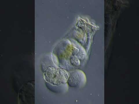 Rotifer đẻ trứng xem qua kính hiển vi