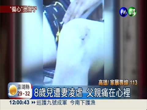 偏心不疼長子 狠母滾水潑傷兒