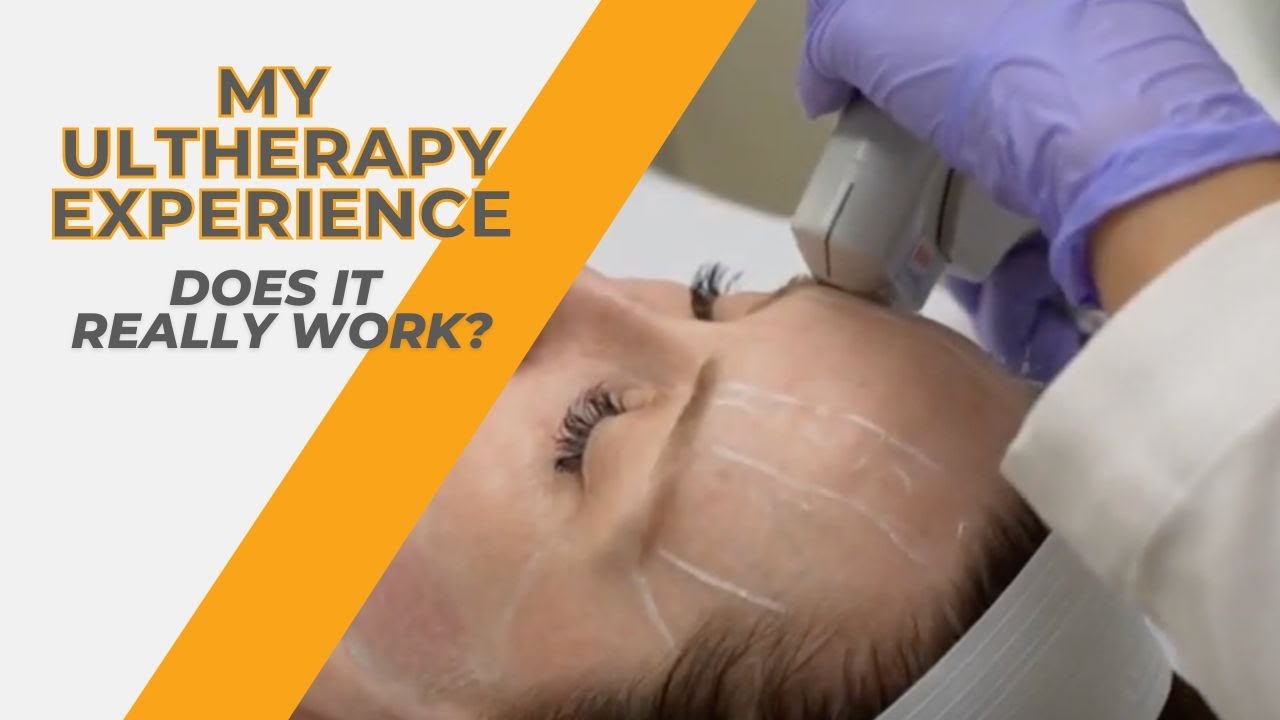 Corey Does Ultherapy