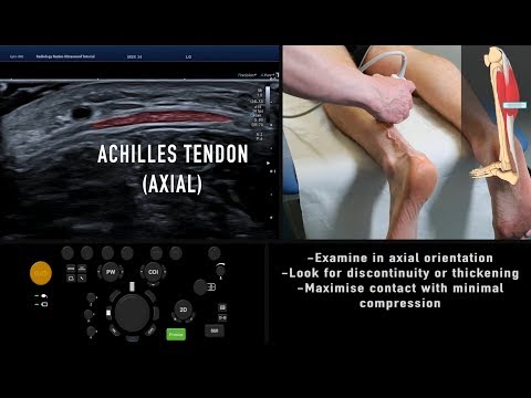 Tutorial USG: układ mięśniowo szkieletowy - ścięgno Achillesa