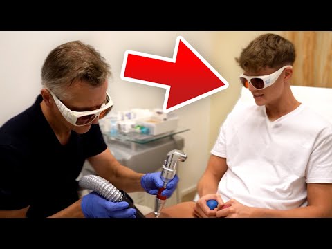 Warum ich mein Tattoo ENTFERNT habe