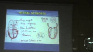 26) Dr.Essam Ezzat 8-12-2015 [ Endocarditis-Valve's Disease-Congenital Heart Diseases ]