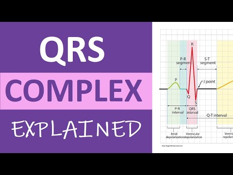 Upside Down Qrs Complex