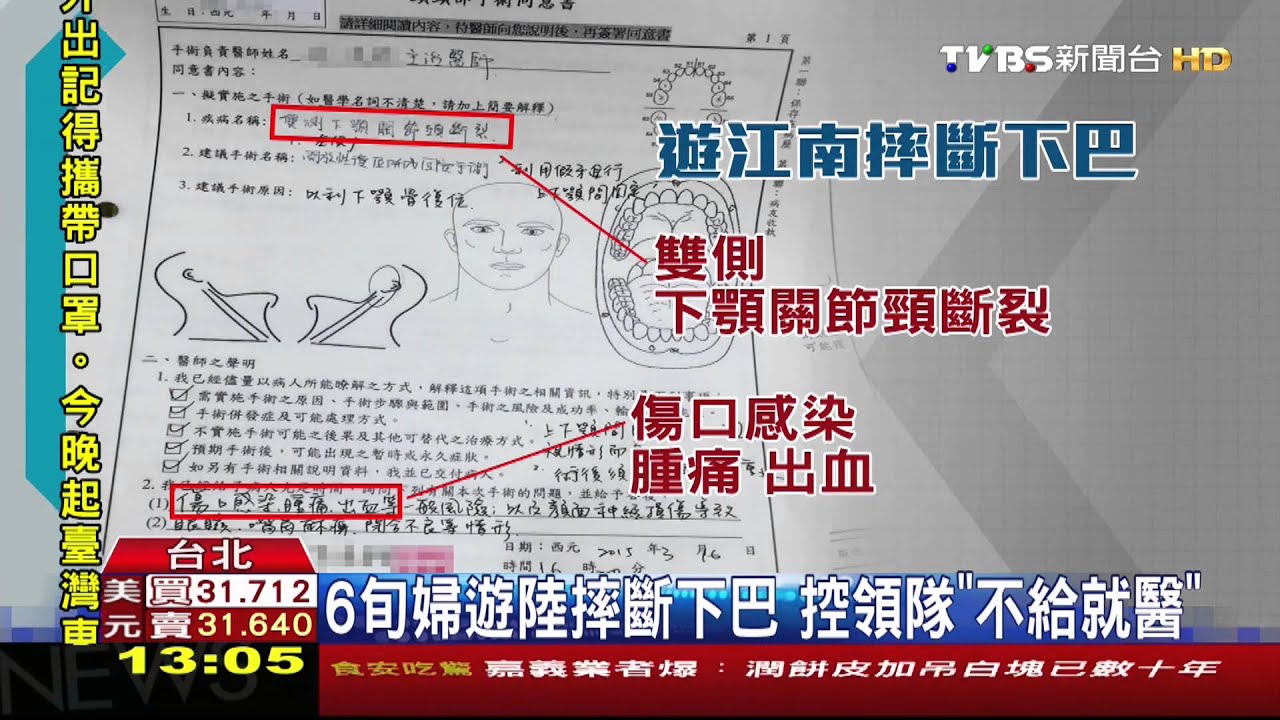 6旬婦遊陸摔斷下巴　控領隊「不給就醫」