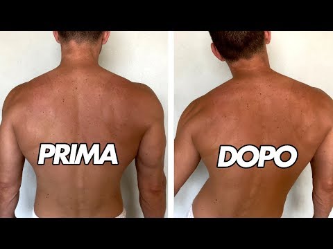 Disturbi urinari cervicali Se a causa di osteocondrosi a perdere i capelli