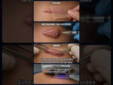 video DYo6mqw574k