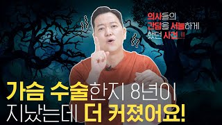 가슴성형전문의들의 간담을 서늘하게 했던 이야기