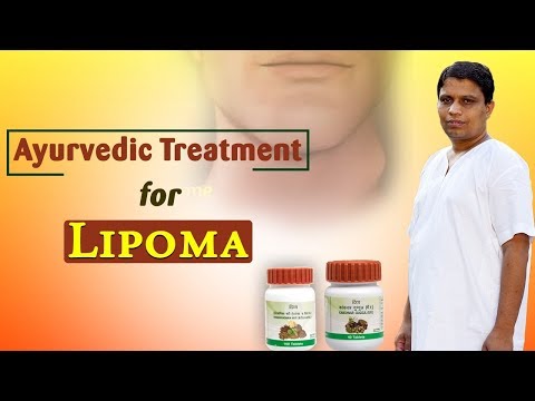 Ayurvedic Treatment for Lipoma | Acharya Balkrishna