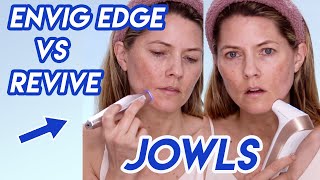 30 Day Jowls Challenge: Envig Edge vs DermRays Revive Laser for Mature Skin