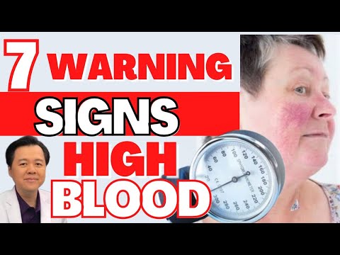 7 Warning Signs ng High Blood.  - By Doc Willie Ong