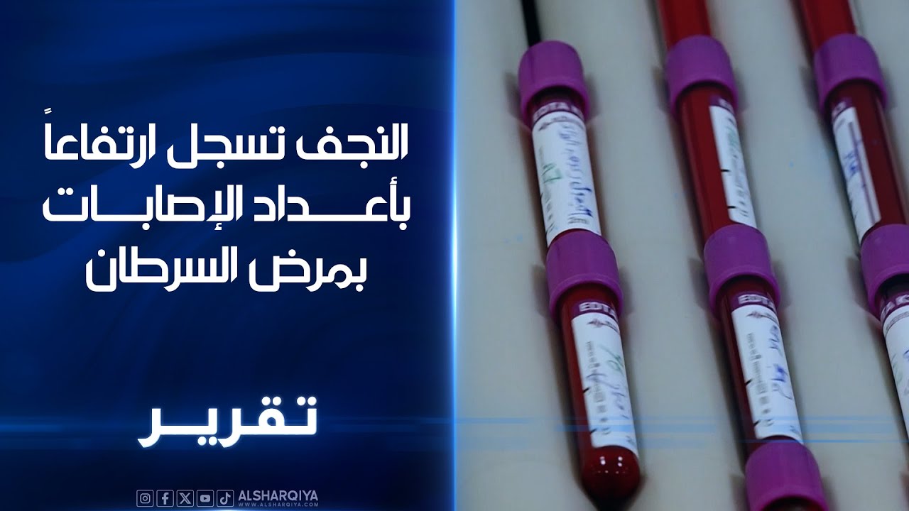 فيديو | أطباء في النجف يدعون إلى تكثيف حملات التوعية بعد ارتفاع عدد الإصابات بمرض السرطان