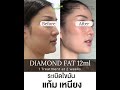 เมโสแฟต ยี่ห้อไหนดี