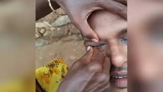 Eye cleaning