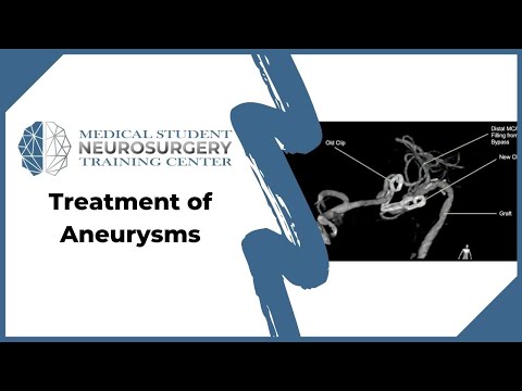 Treatment of Aneurysms