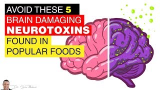 🧠 Avoid These 5 Brain Damaging Neurotoxins Found In Popular Foods - by Dr Sam Robbins