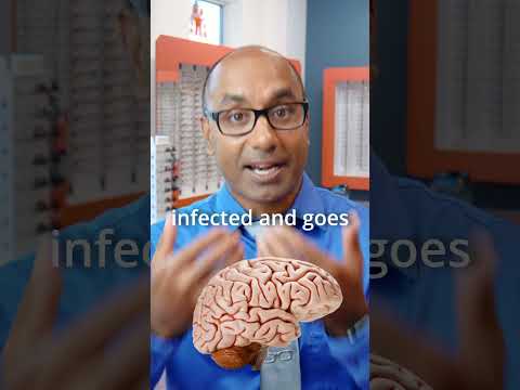 Should You Pop a Stye? | Answers from an Eye Doctor! #eyecaretips