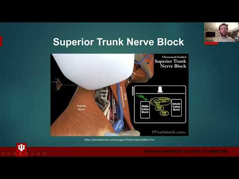 Superior Trunk Nerve Block by Blake Brookshire, MD Candidate Class of 2023