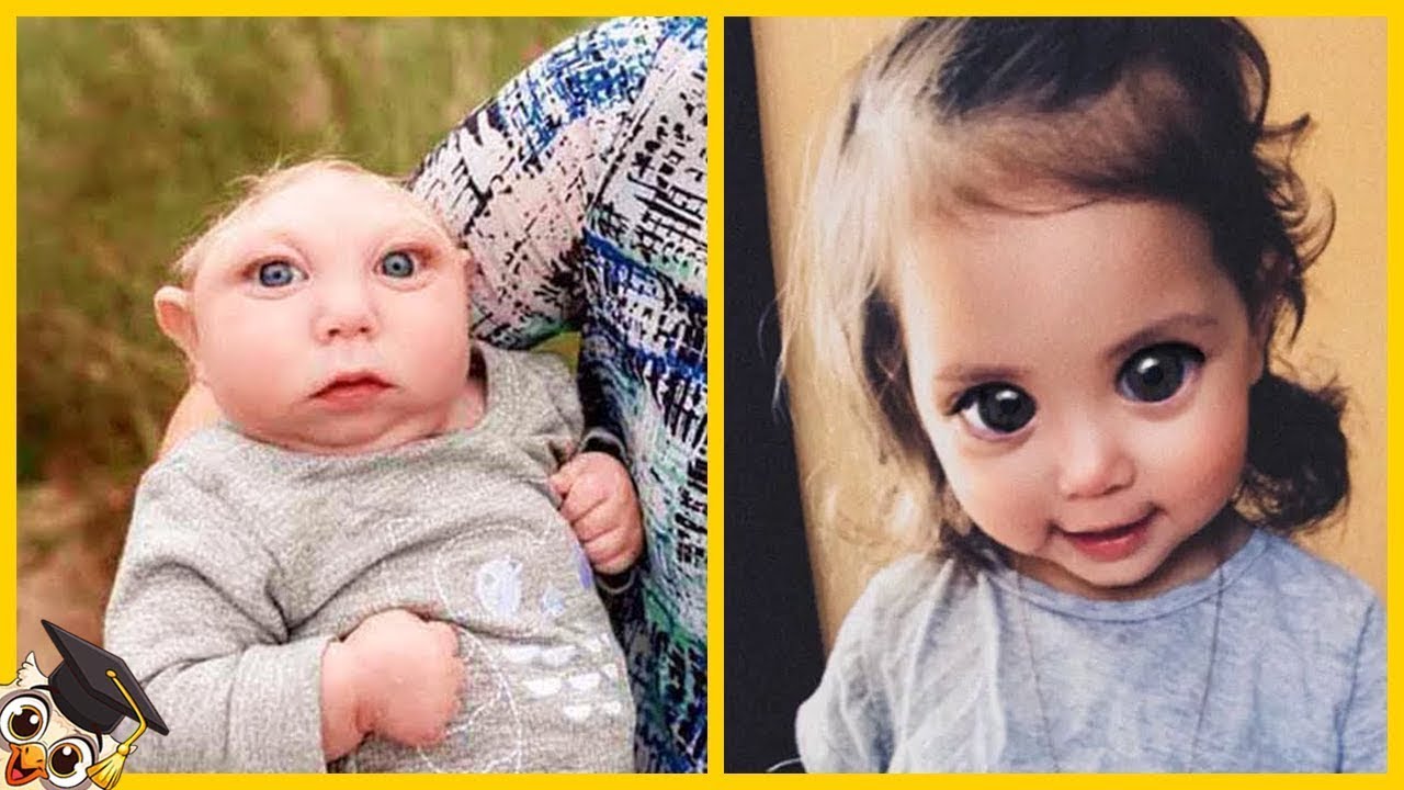 20 Crianças Que Nascem Apenas Uma Vez A Cada Mil Anos