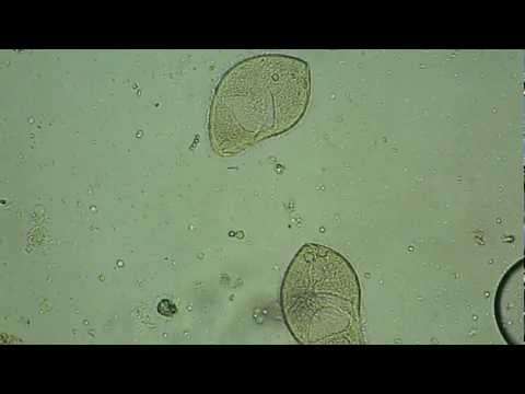 Il trasferimento è emozionante vivere su parassiti in un corpo umano Quale helminths in pesce di mare