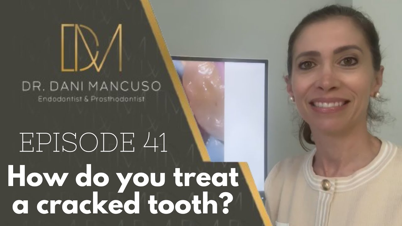 The Diary of an Endodontist - Episode 41 – Can You Save a Cracked Tooth?