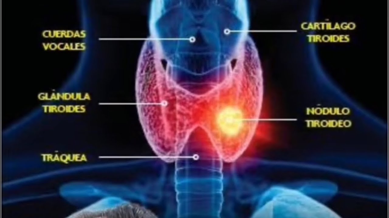 Sergio Alberto Mendoza Alvarez-47