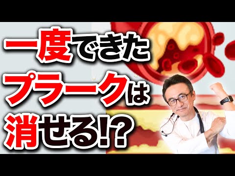 大動脈石灰化：その正体、症状、治療