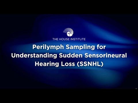 Perilymph Sampling for Understanding Sudden Sensorineural Hearing Loss (SSNHL)