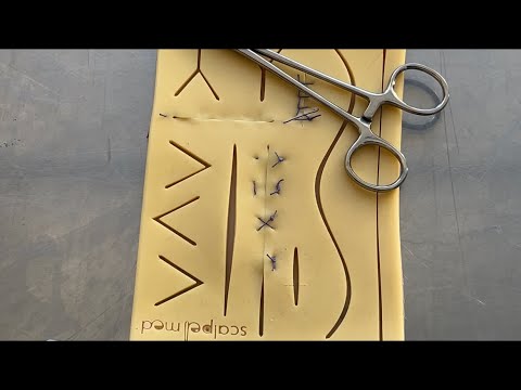 8 Shaped suture and Half Buried Mattress suture