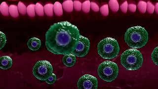 Qué es un pólipo adenomatoso