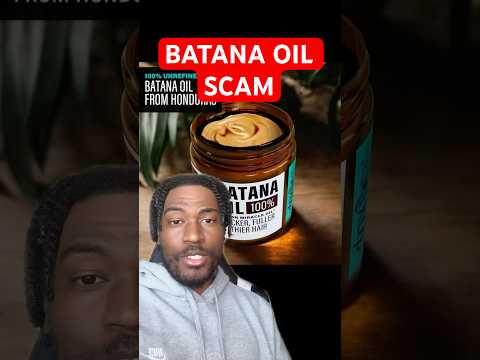 STOP USING BATANA OIL #hairgrowth #hairlosstreatment #bald #alopecia