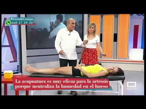 radiális artrosis kötőszöveti diszplázia betegség ütemezése