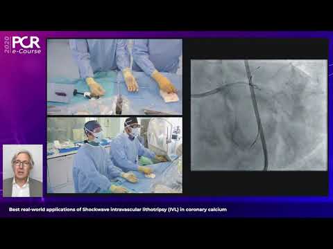 Best real-world applications of Shockwave IVL in coronary calcium - PCR e-Course 2020