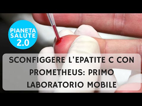 Le maschere per candeggiare della persona da argilla Vitamine a posti di pigmentary