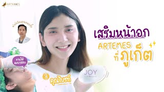 รีวิวเสริมหน้าอกสาวสอง ด้วยซิลิโคน Motiva JOY (Ergonomix 2)