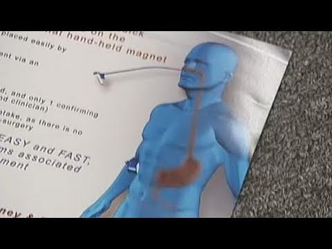 NEOtropolis: Innovations in Feeding Tube Technology