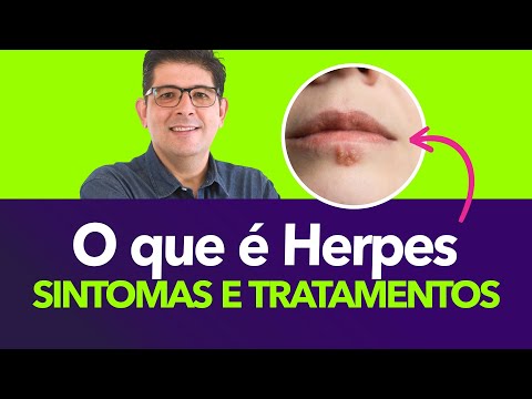 Herpes: tipos, sintomas e tratamentos | Dr Juliano Teles