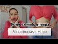 Diário Da Minha Cirurgia ABDOMINOPLASTIA LIPO E ENXERTO