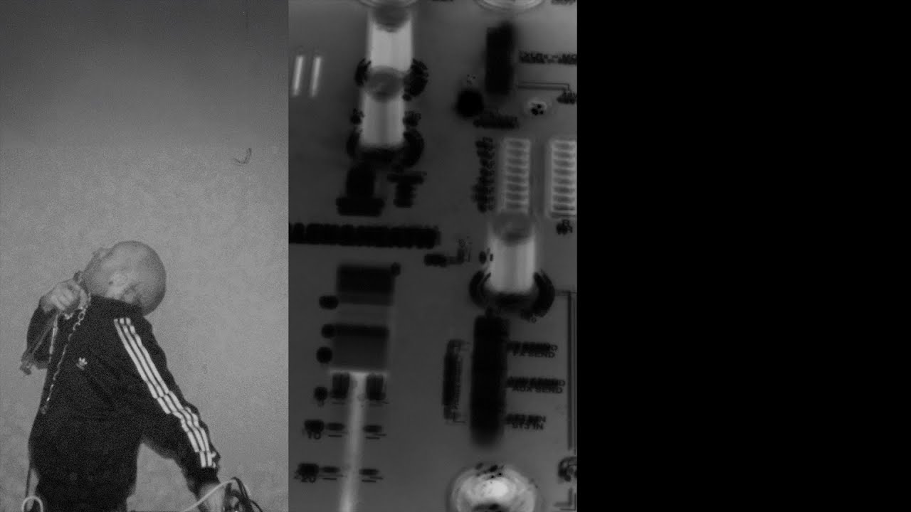 exome_ultranegative x radiocarme