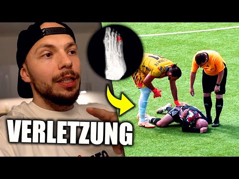 I injured myself playing soccer... (Ouch)