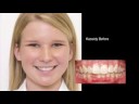 download lagu mp3 mp4 Innovation C Braces, download lagu Innovation C Braces gratis, unduh video klip Innovation C Braces