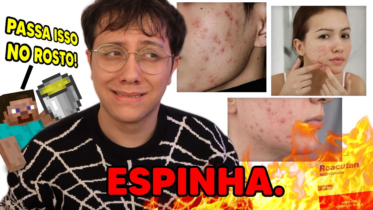 TER ESPINHA NA ADOLESCÊNCIA FOI UM INFERNO