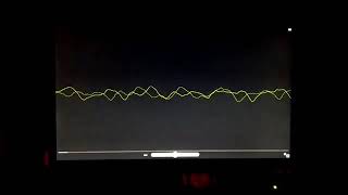 QUANTO SPACCA LA BASE DI XNX?  SFERA EBBASTA - XNX (ALBUM: ROCKSTAR)